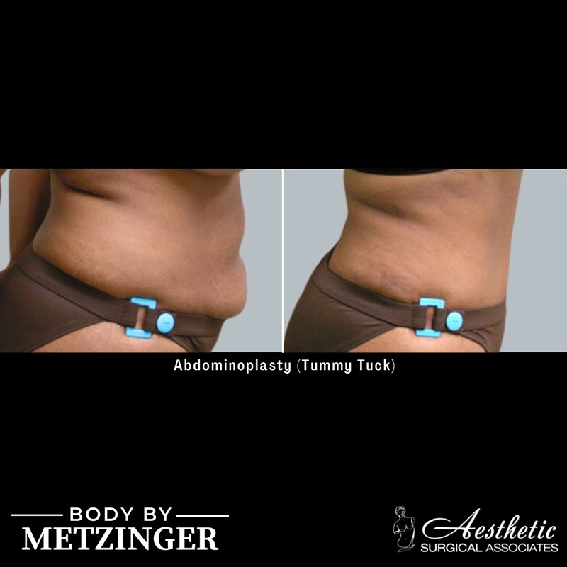 ASA B&A Library Overflow - 4