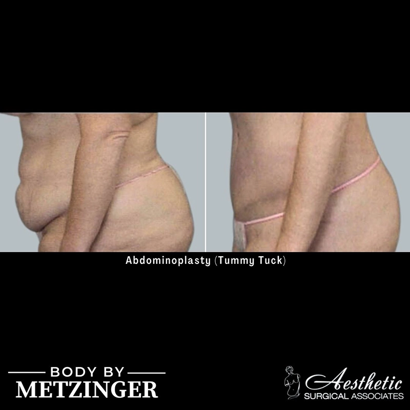 ASA B&A Library Overflow - 6