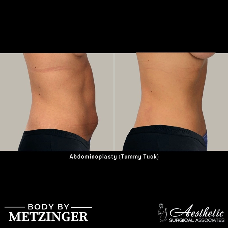 ASA B&A Library Overflow - 8