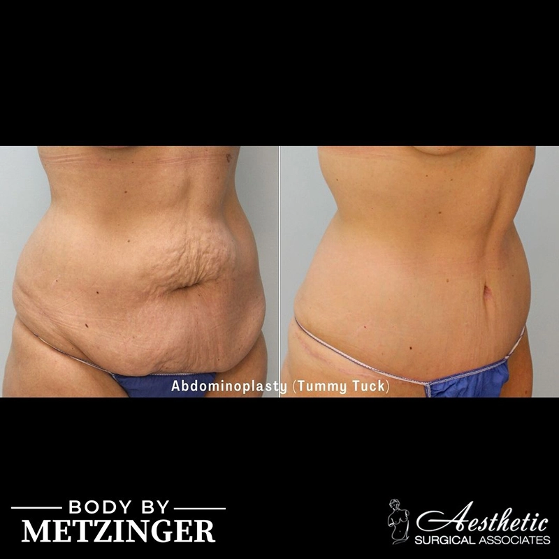 ASA B&A Library Retouched - 18