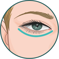 Lower Eyelid Banner