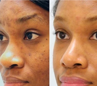 Face Treatment Banner