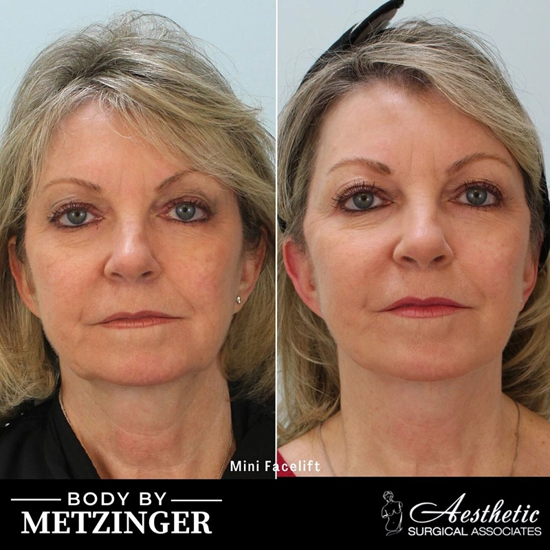 ASA B&A Library Retouched - 106