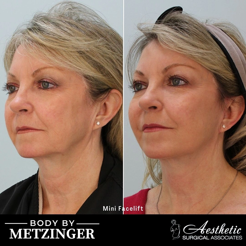 ASA B&A Library Retouched - 107