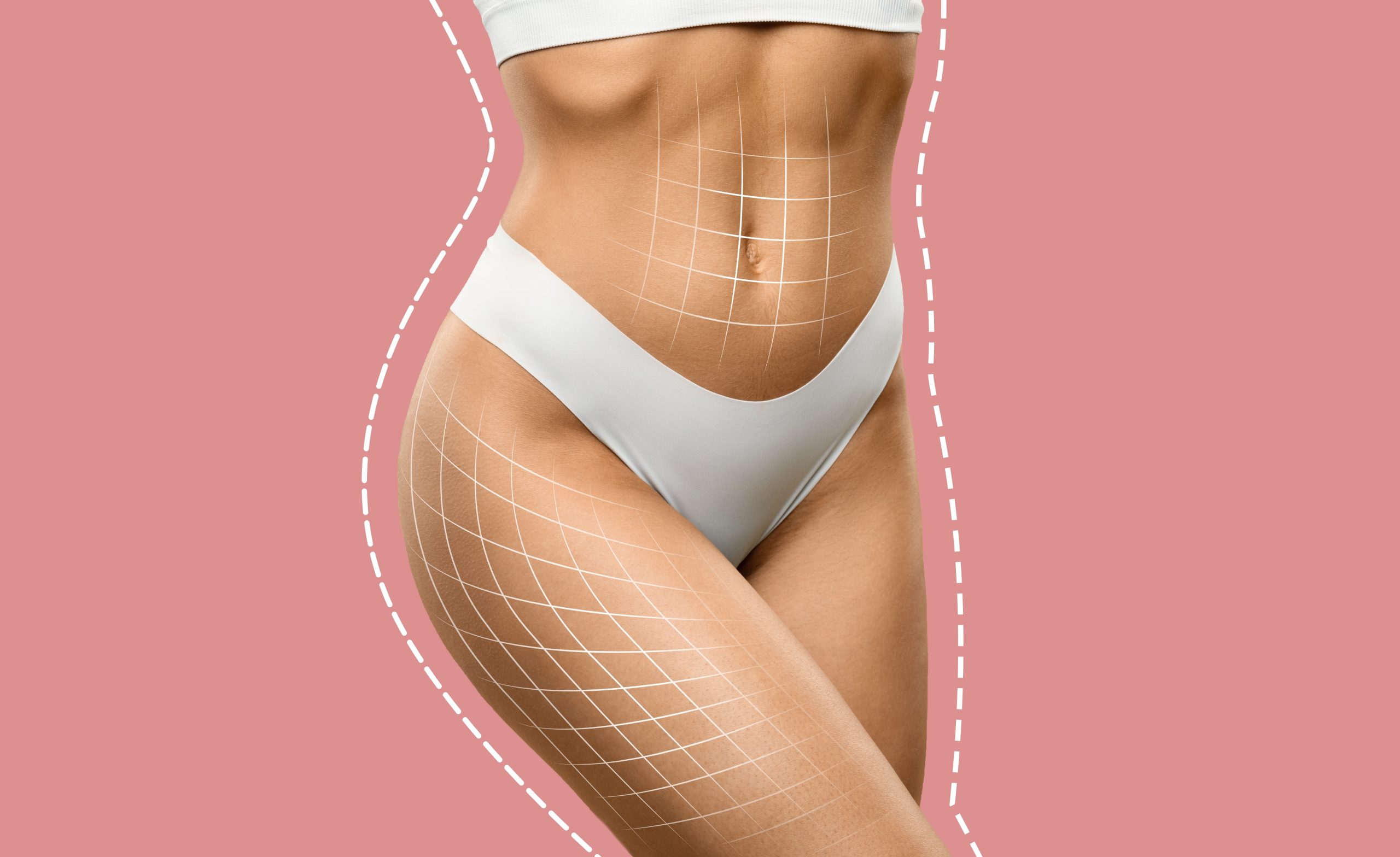Am I a Good Candidate for Liposuction? Factors That Determine Your Results banner
