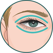 Quad Blepharoplasty Banner