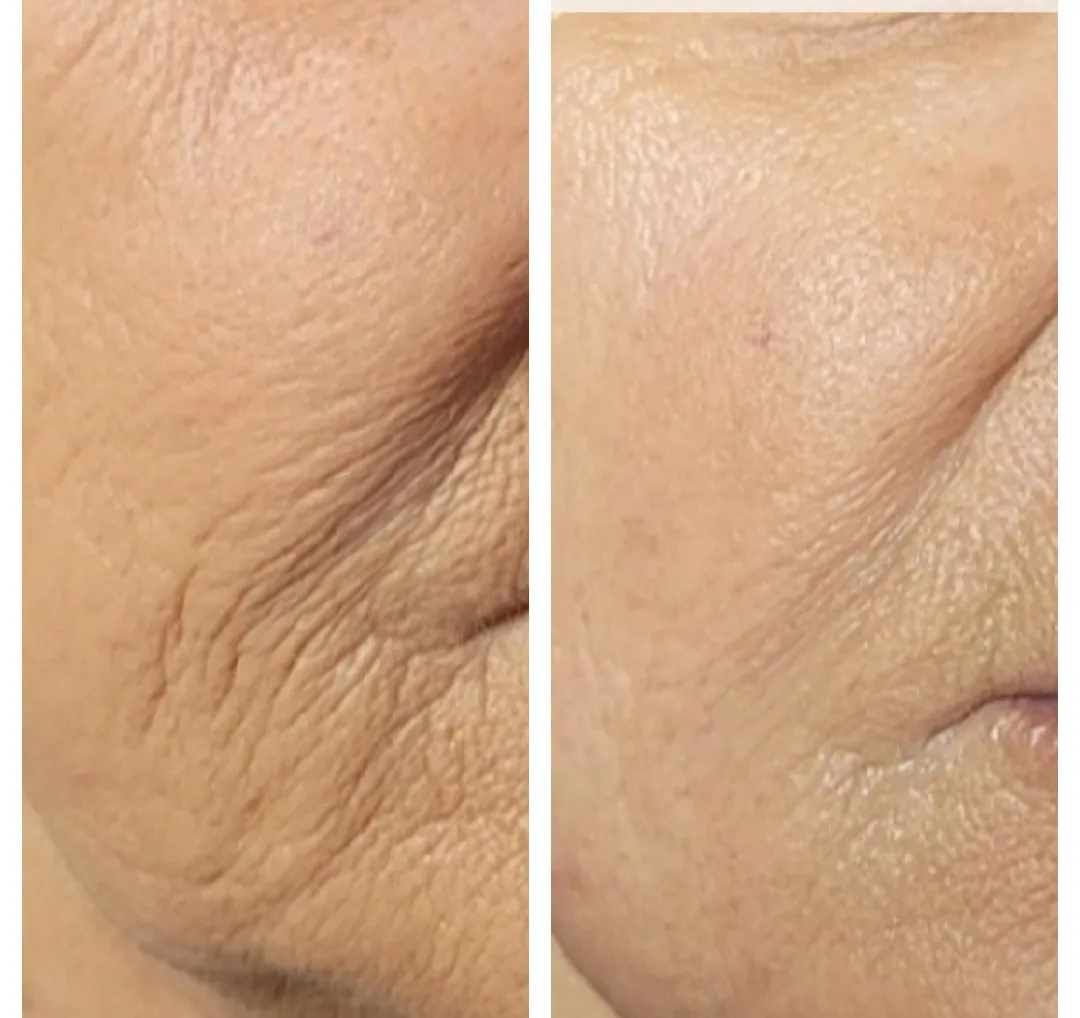 Face and neck-27