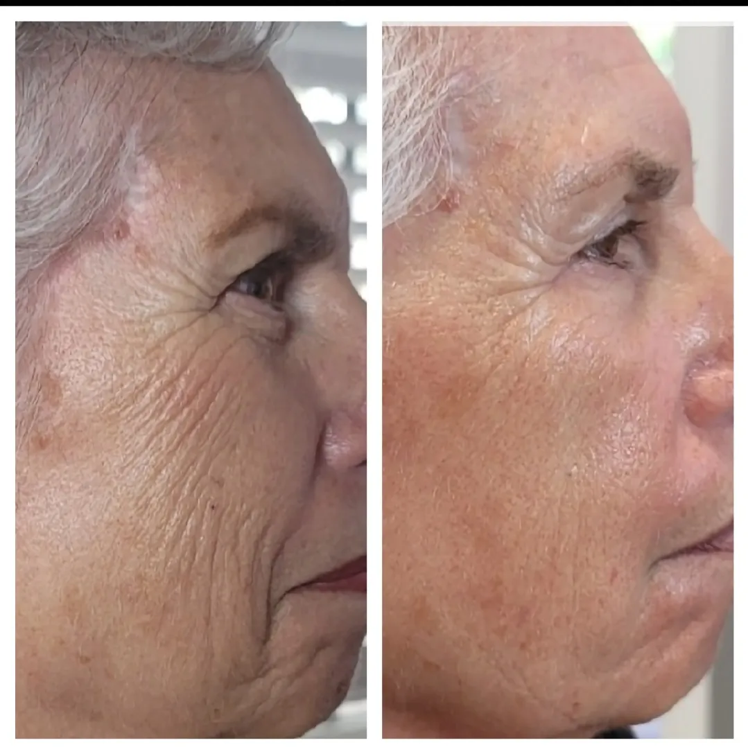 Face and neck-28