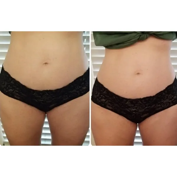 abs-8