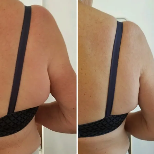 back-and-flanks-10.1