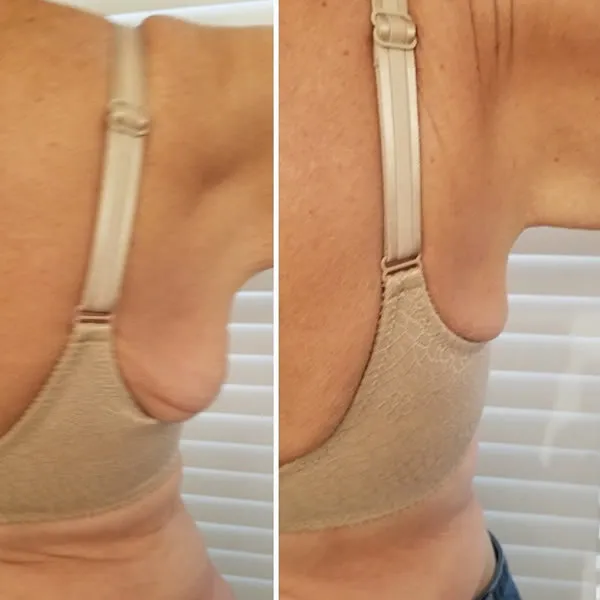 back-and-flanks-2.1