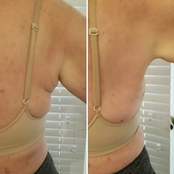 back-and-flanks-4.1