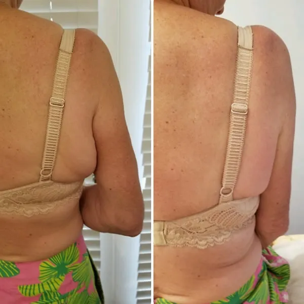 back-and-flanks-7.1