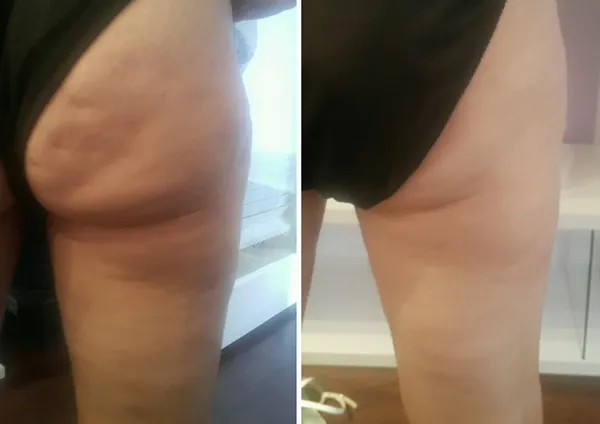 legs-and-thighs-7