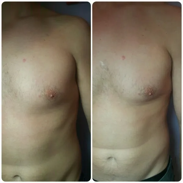 mans-chest-1.1