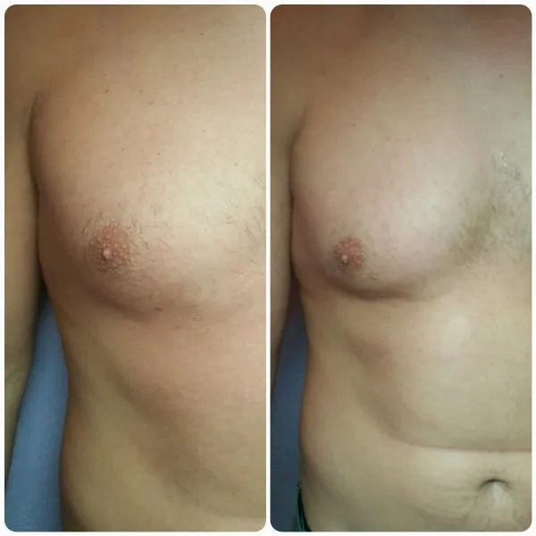 mans-chest-1