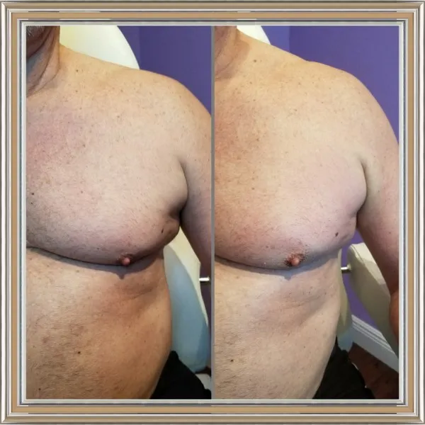 mans-chest-2