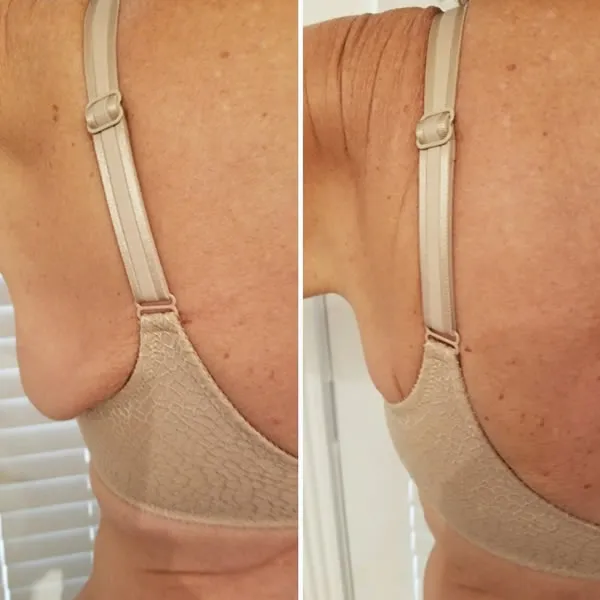 back-and-flanks-2