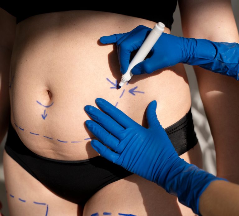 mini tummy tuck austin Procedures image