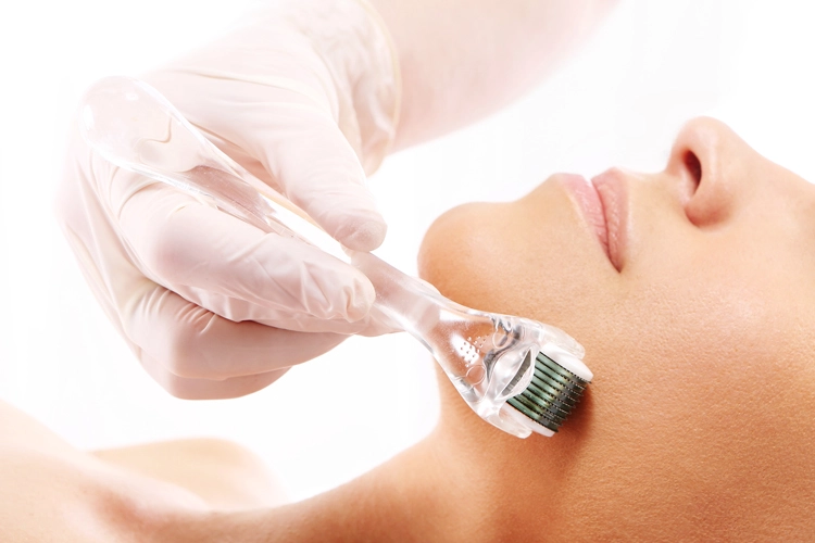 Aspira-Microneedling-Texas