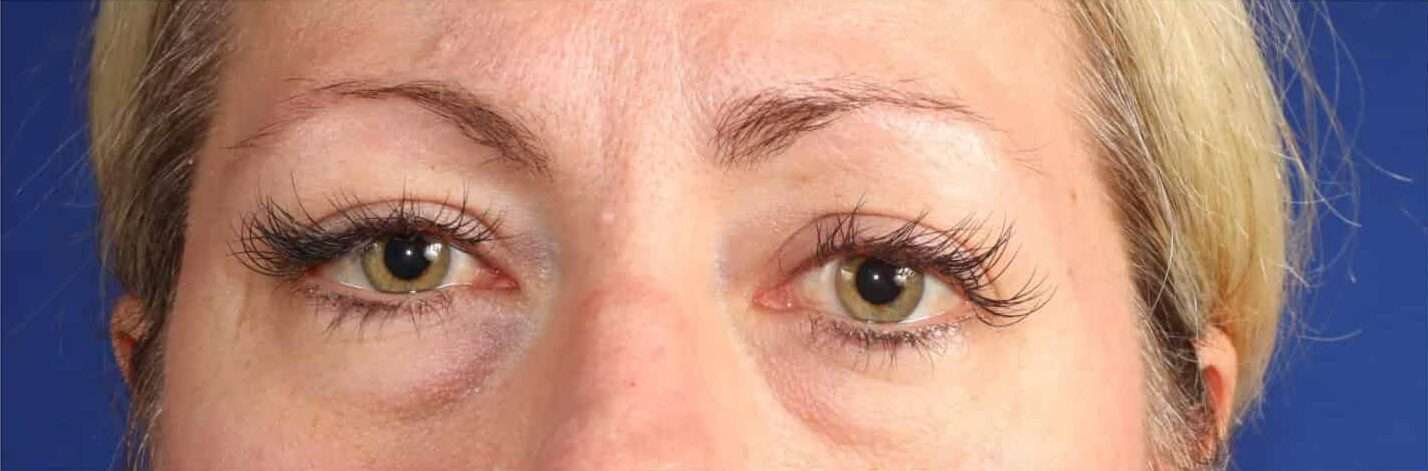 11-4-scaled-e1709225201426