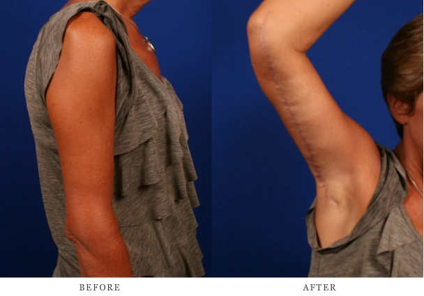 Case 1.3 before & after