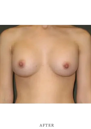 Case 15 after