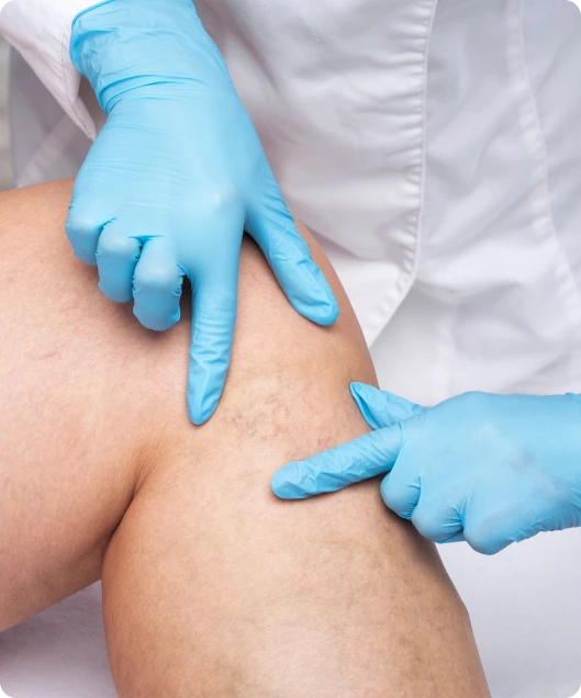 Vein Treatment in Springfield, MO: Venous Insufficiency Banner