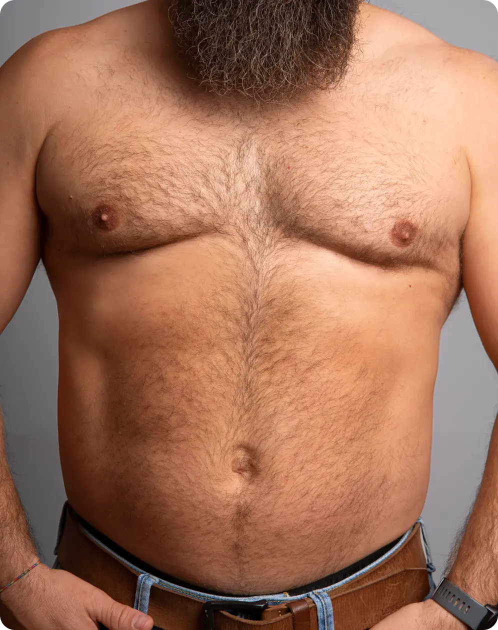 Gynecomastia surgery Information Banner Image