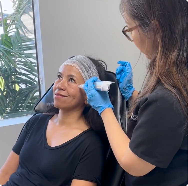 Professional Microneedling in San Jose, CA Banner