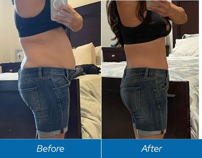 Weight Loss (2)