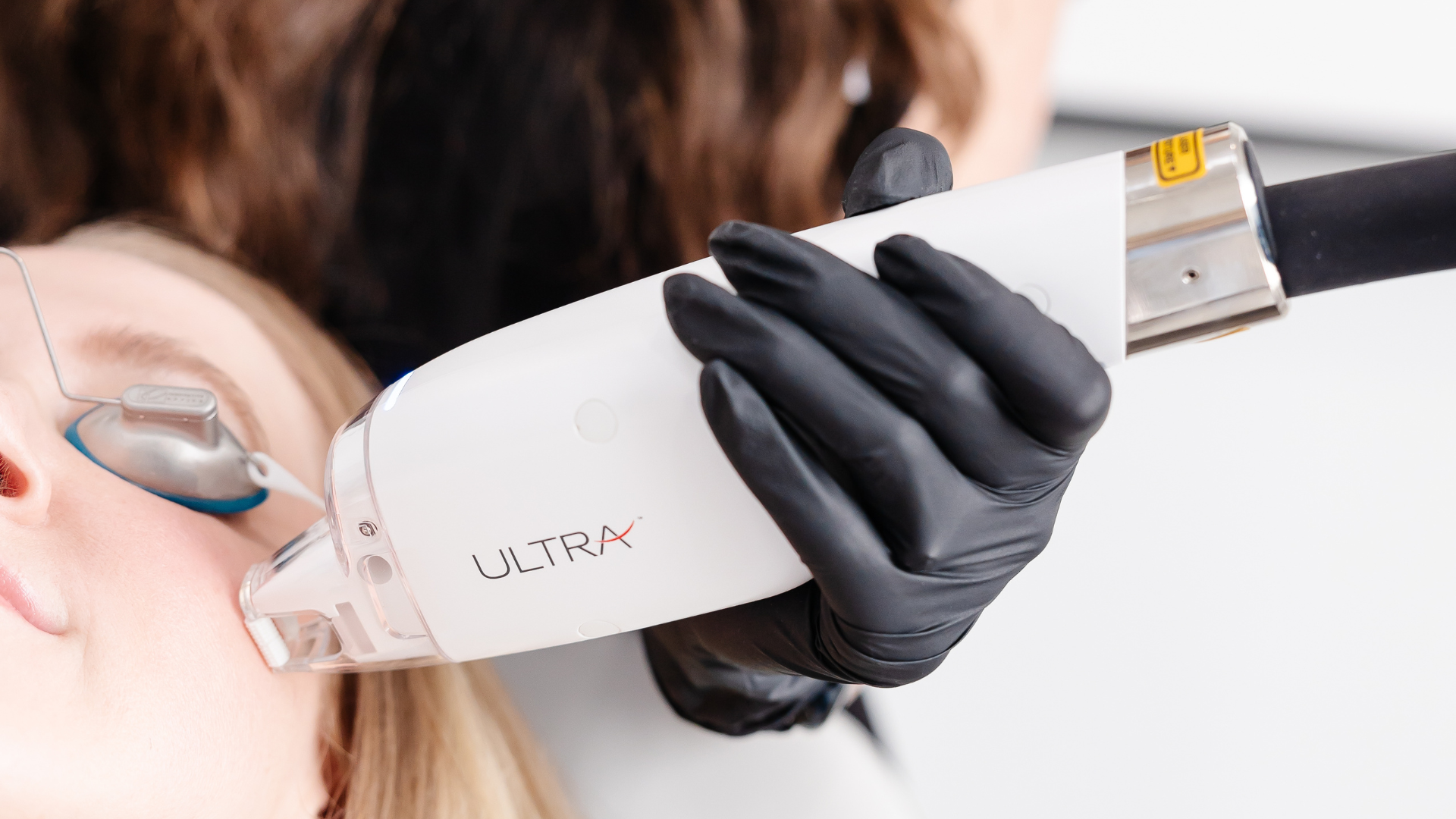 Laser Resurfacing San Jose, CA Banner
