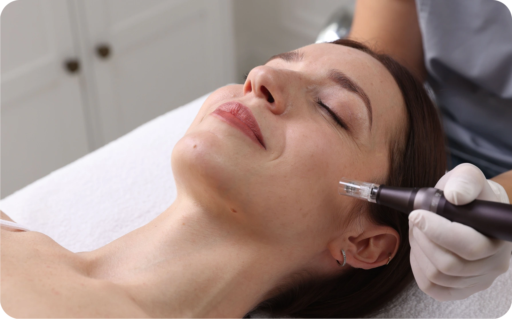 Provider performing microneedling treatment on a patient's face with a handheld device