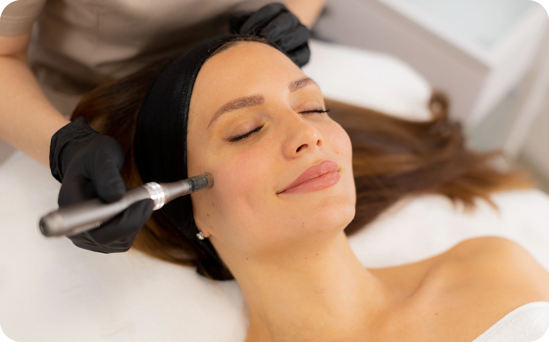 Provider performing microneedling treatment on patient's cheek at Blu Cocoon MedSpa