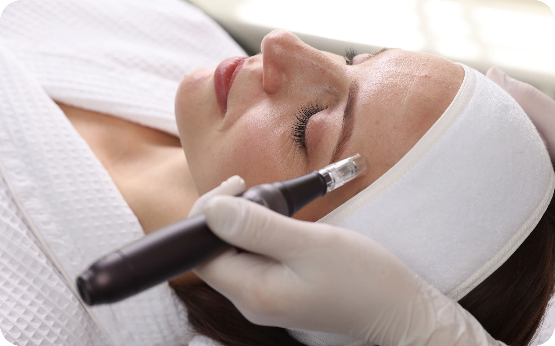 Provider performing microneedling treatment on a patient's cheek with a handheld device