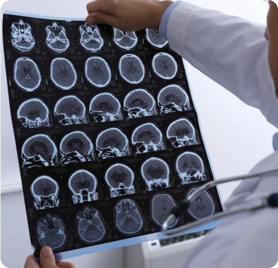Doctor holding brain MRI scan images showing multiple axial and sagittal cross-sections