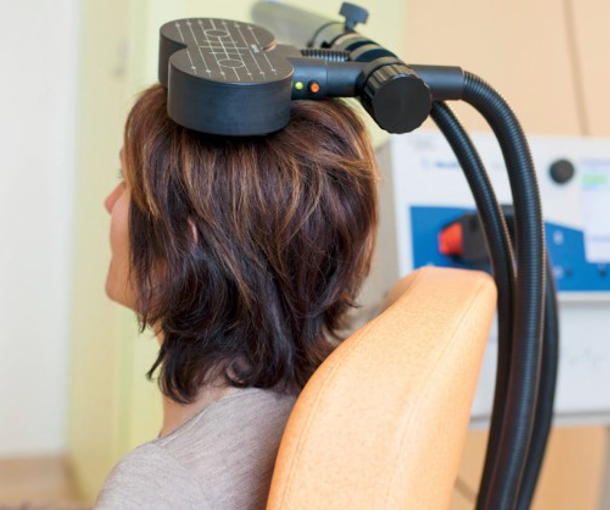 Patient receiving transcranial magnetic stimulation (TMS) treatment with coil positioned on scalp