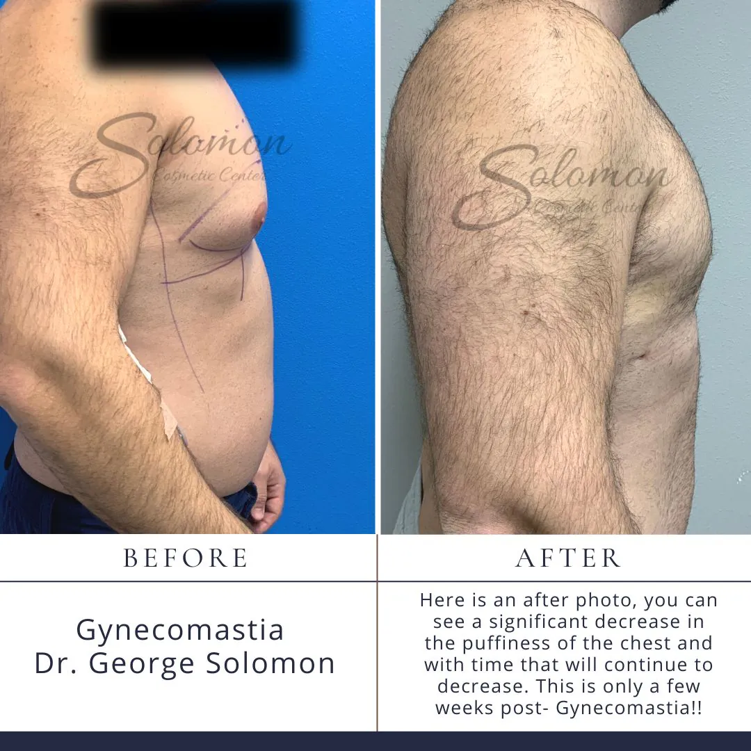 11_(1)_(1)_(1)_(1)_(1)_(1)_(1)_(1)_(1)