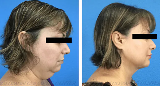 1_(1)_(1)_(1)_(1)_(1)_(1)_(1)