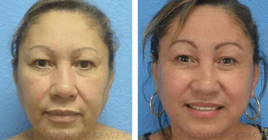 1_(1)_(1)_(1)_(1)_(1)_(1)_(1)_(1)