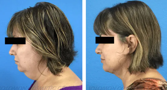 2_(1)_(1)_(1)_(1)_(1)_(1)