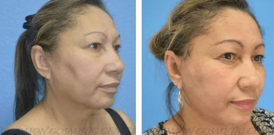 2_(1)_(1)_(1)_(1)_(1)_(1)_(1)