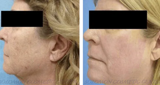 3_(1)_(1)_(1)_(1)_(1)_(1)_(1)_(1)_(1)_(1)_(1)_(1)_(1)_(1)_(1)