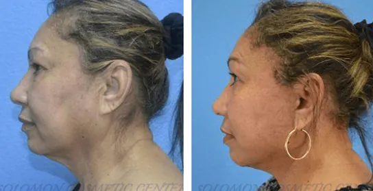 5_(1)_(1)_(1)_(1)_(1)_(1)_(1)