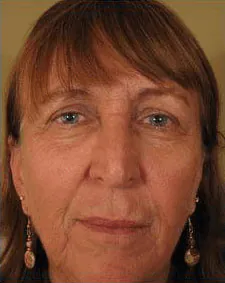 Aftercare Recovery Banner