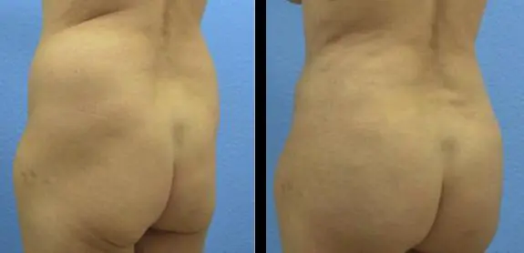 image-2022-05-20T105018.428