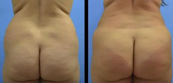 image-2022-05-20T105922.263