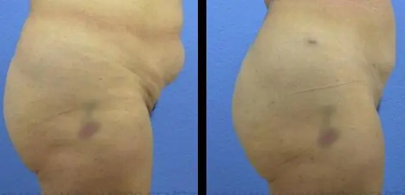 image-2022-05-20T110820.950