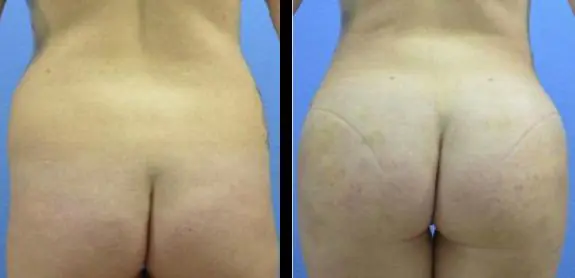 image-2022-05-20T112013.023