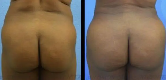 image-2022-05-20T112341.605